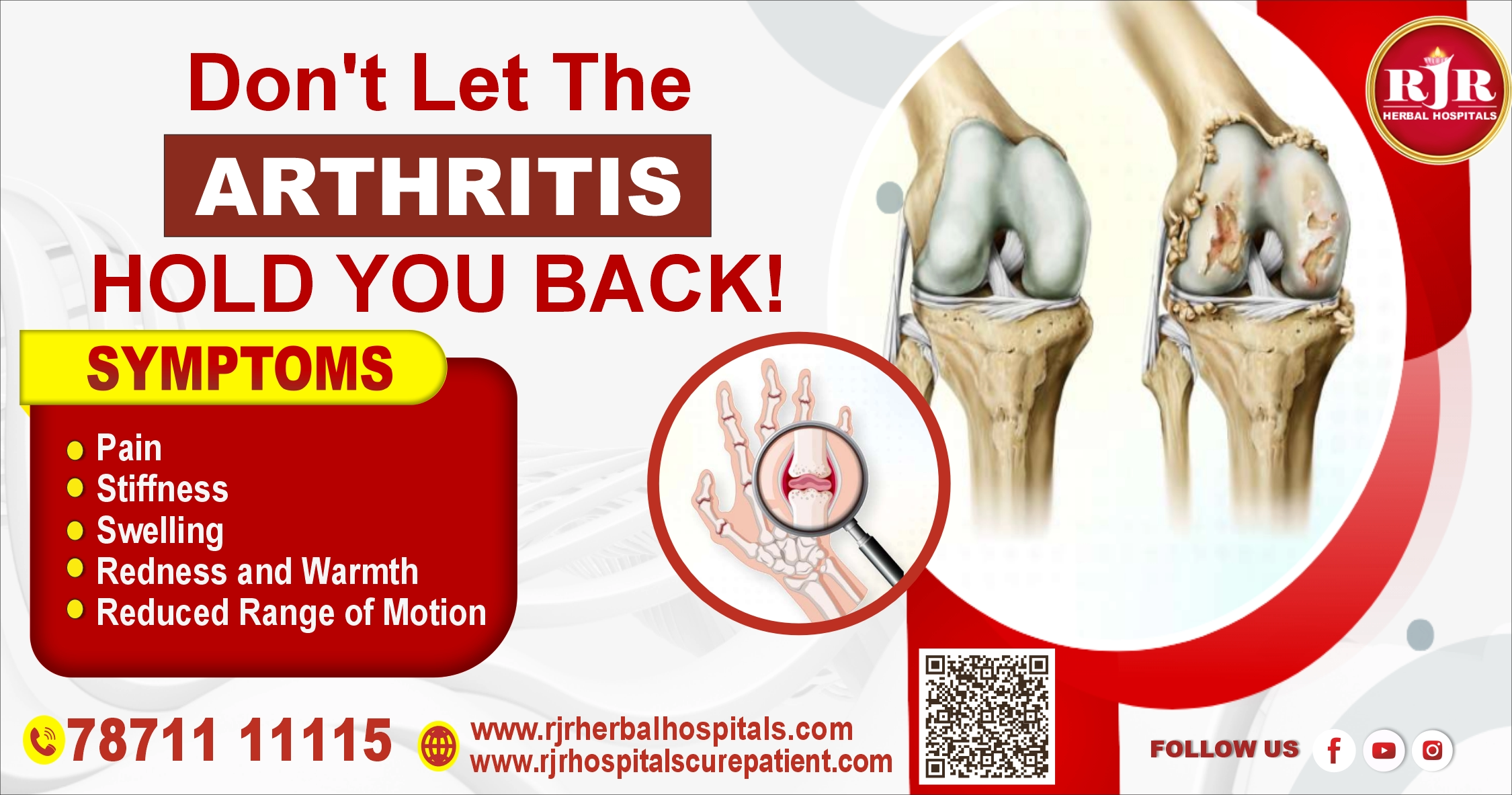 paralysis treatment for chennai tamilnadu 