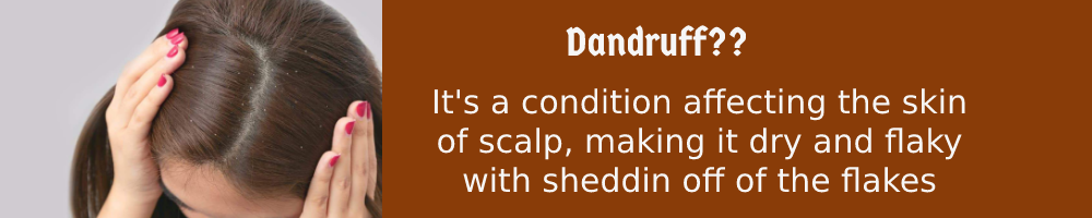 Dandruff Treatment 