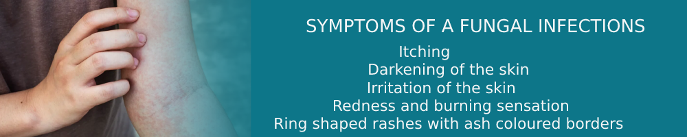 Spondylosis 